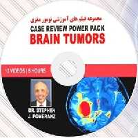 Case Review Power Pack – Brain Tumors at 10€ - کتاب پزشکی بهار