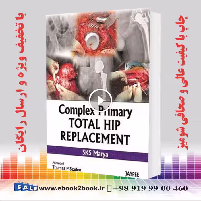 Complex Primary Total Hip Replacement
