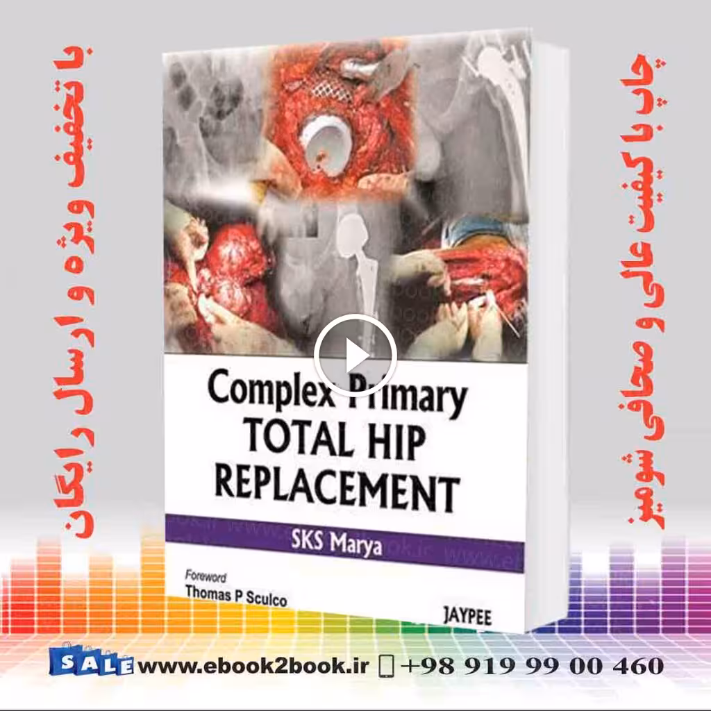 Complex Primary Total Hip Replacement