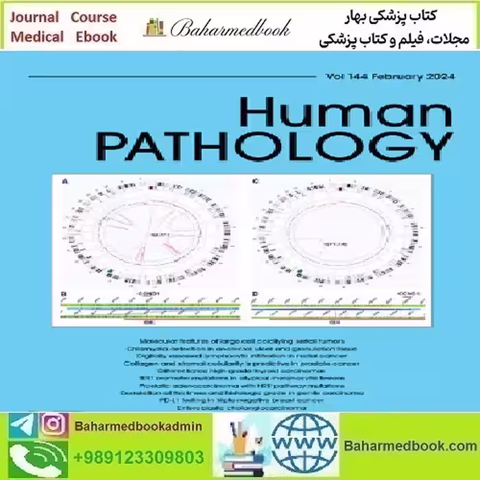 Human Pathology Volume 143 to 144 2024 TRUE PDF price 10€ - کتاب پزشکی بهار