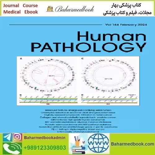 Human Pathology Volume 143 to 144 2024 TRUE PDF price 10€ - کتاب پزشکی بهار