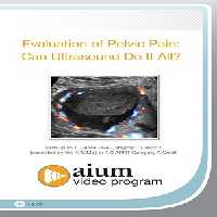 Evaluation of Pelvic Pain: Can Ultrasound Do It All? at 18€ - کتاب پزشکی بهار
