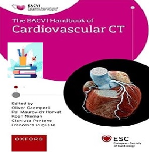 EACVIEACVI Handbook of Cardiovascular CT TRUE PDF price 1€