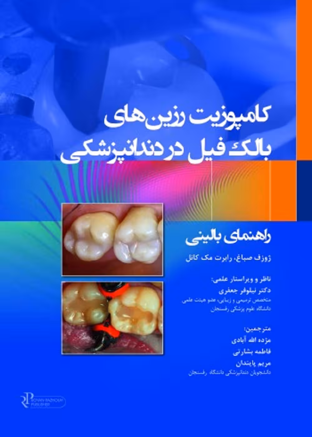 کامپوزیت رزین های بالک فیل در دندانپزشکی 2023 راهنمای بالینی