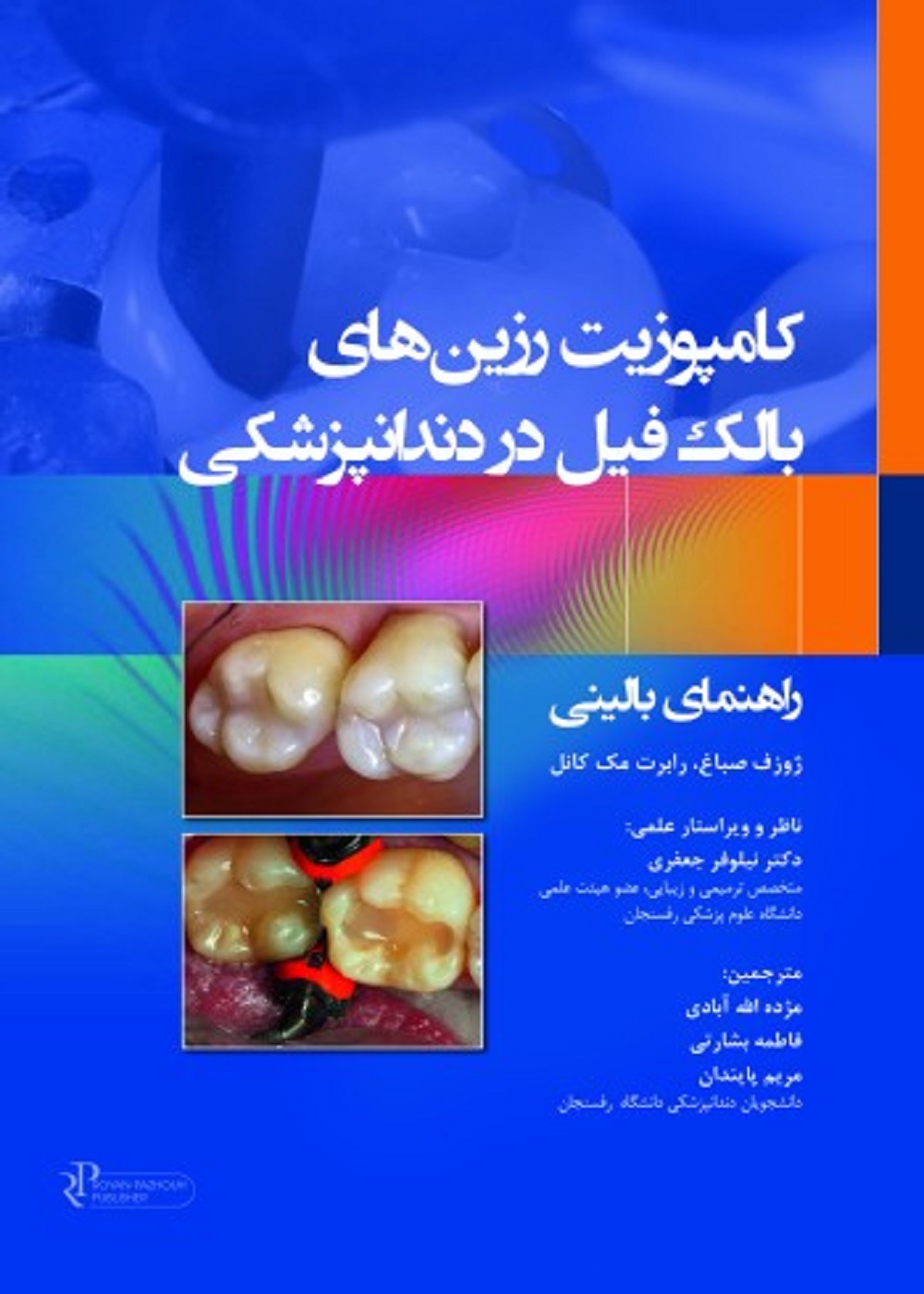 کامپوزیت رزین های بالک فیل در دندانپزشکی 2023 راهنمای بالینی