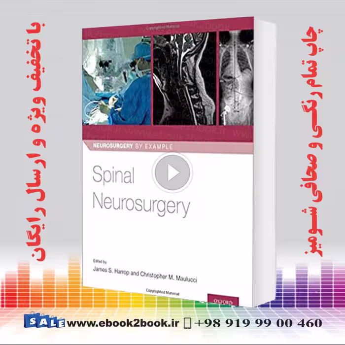 Spinal Neurosurgery