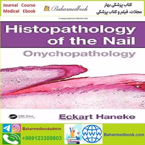 Histopathology of the Nail Onychopathology TRUE PDF price 1€ - کتاب پزشکی بهار