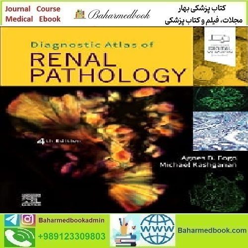 Diagnostic Atlas of Renal Pathology 2022 TRUE PDF price 2€ - کتاب پزشکی بهار