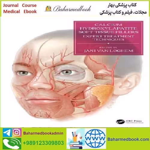 Calcium Hydroxylapatite Soft Tissue Fillers Expert Treatment Tec