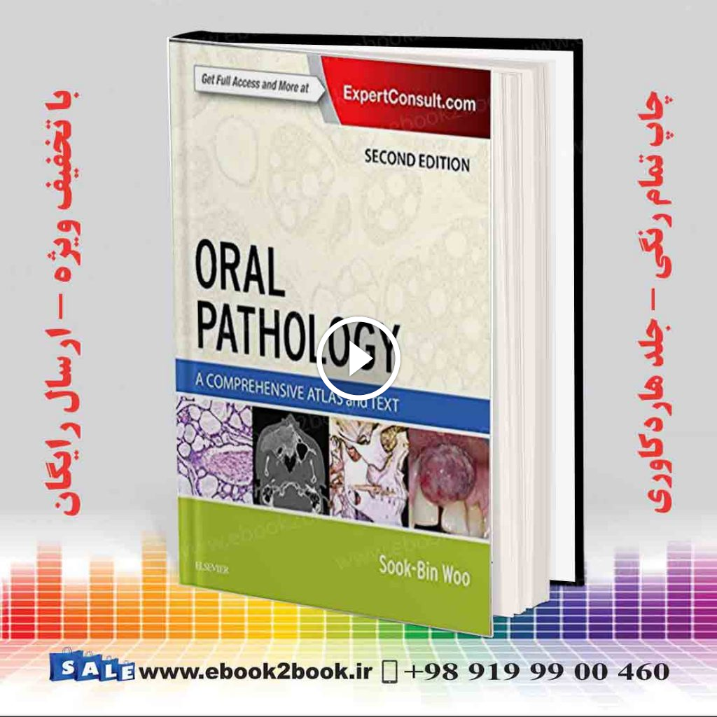 Oral Pathology 2nd Edition