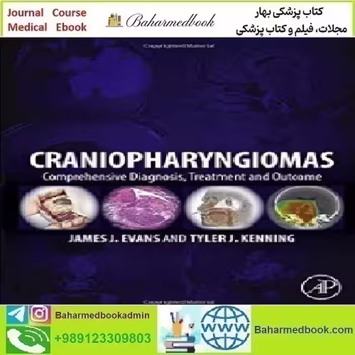 Craniopharyngiomas Comprehensive Diagnosis Treatment an