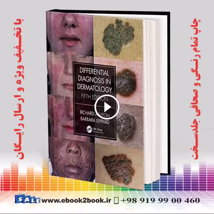 Differential Diagnosis in Dermatology 5th Edition