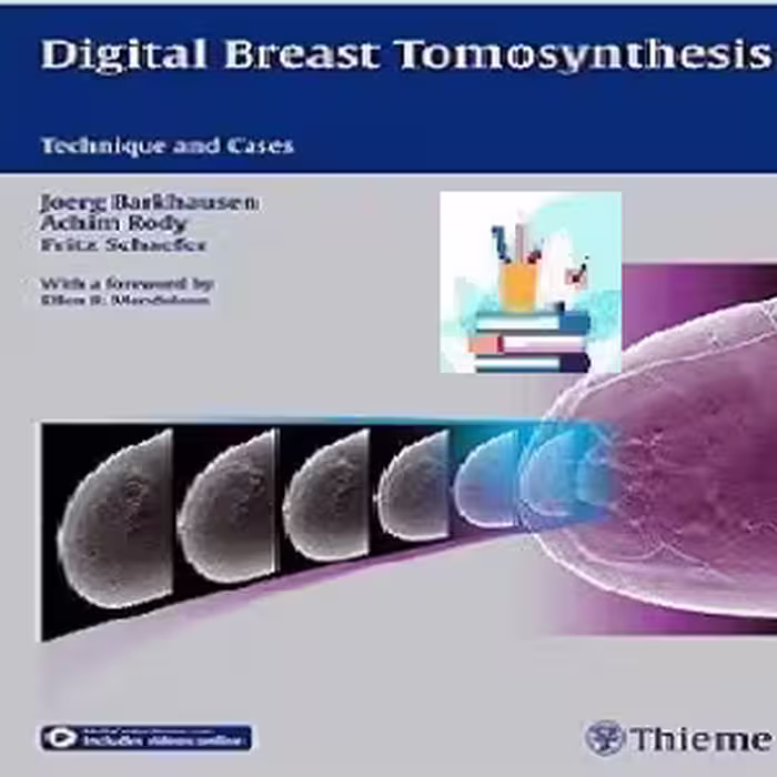Digital Breast Tomosynthesis TRUE PDF price 1€