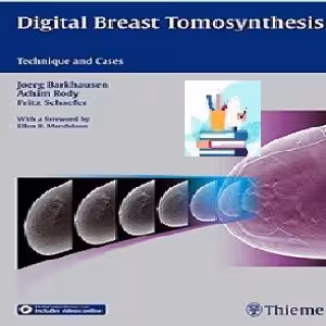 Digital Breast Tomosynthesis TRUE PDF price 1€