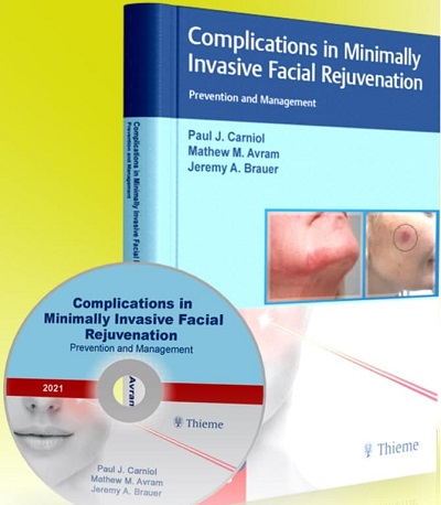 Complications in Minimally Invasive Facial Rejuvenation Prevention and Management PDF VIDEO 2021 Price 15€ - کتاب پزشکی بهار