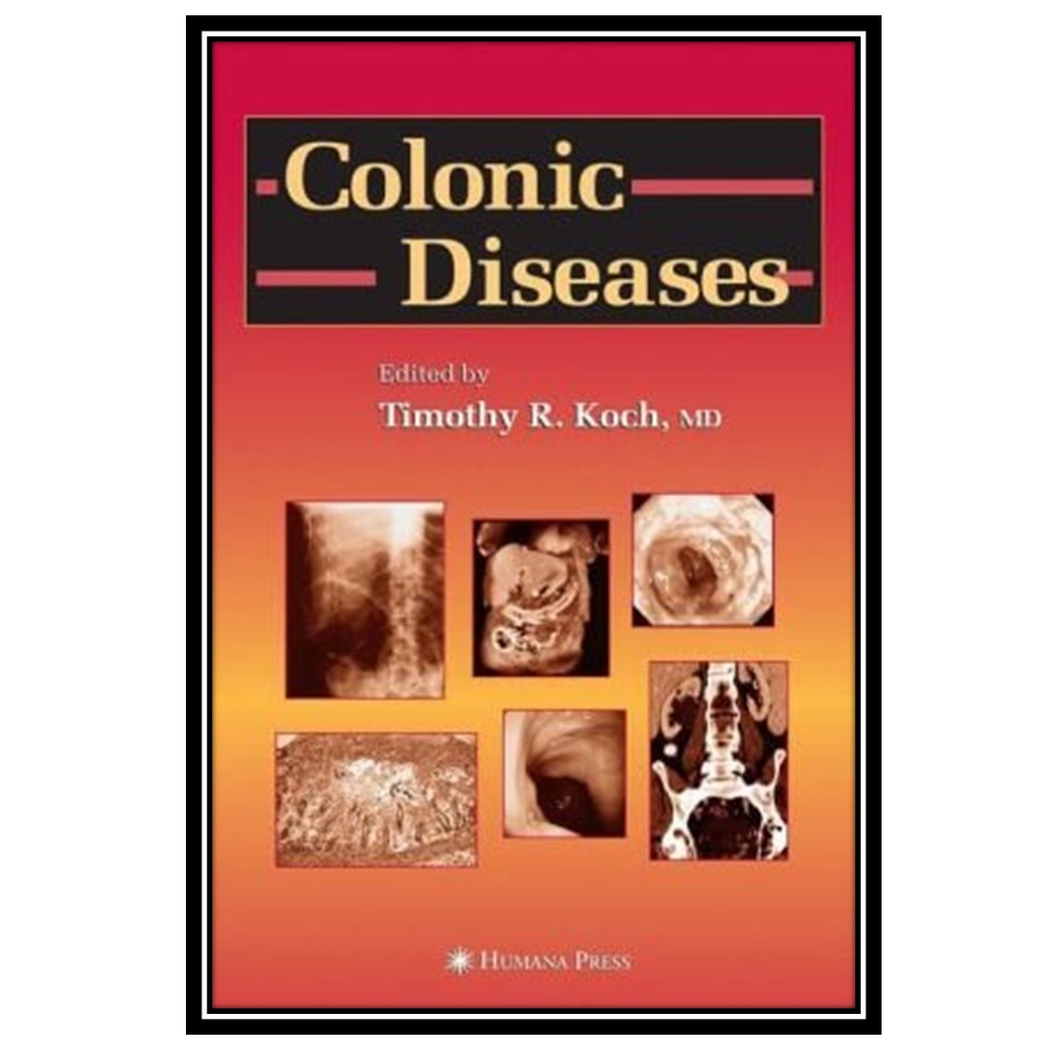 کتاب Colonic Diseases اثر Timothy R Koch انتشارات مؤلفین طلایی