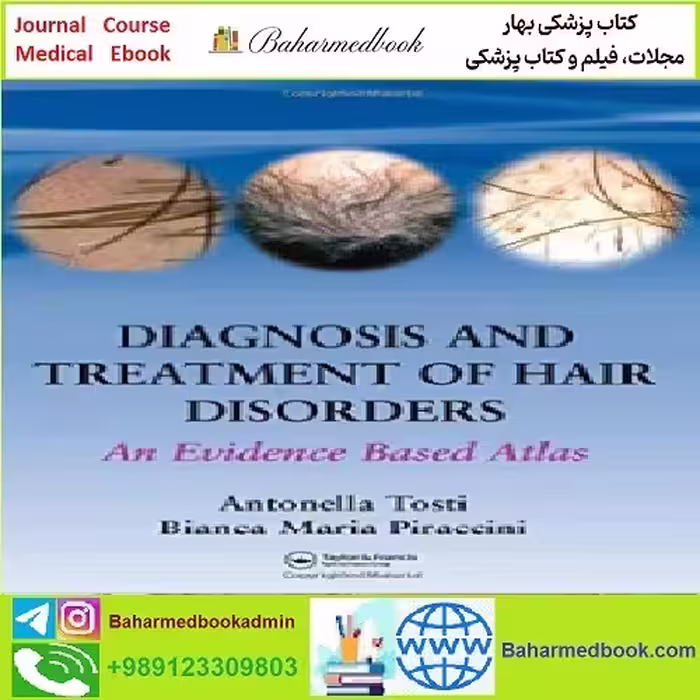 Diagnosis and Treatment of Hair Disorders An Evidence Based At