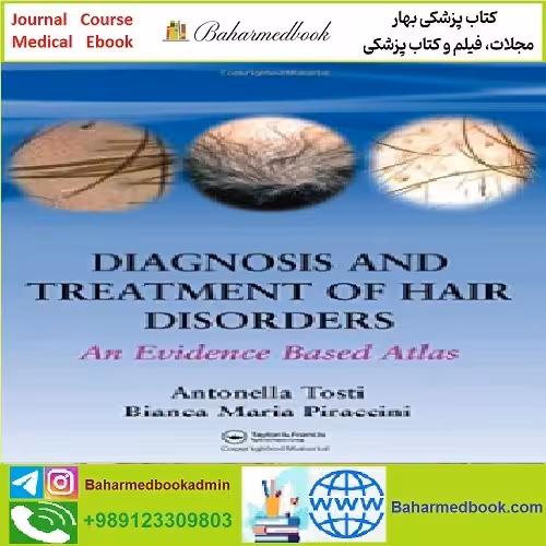 Diagnosis and Treatment of Hair Disorders An Evidence Based At