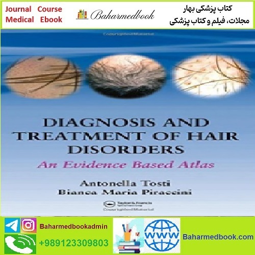 Diagnosis and Treatment of Hair Disorders An Evidence Based At