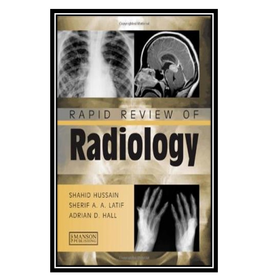 کتاب Rapid Review of Radiology اثر جمعی از نویسندگان انتشارات مؤلفین طلایی