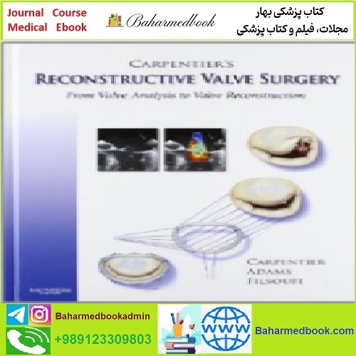 Carpentier's Reconstructive Valve Surgery TRUE PDF price 1€ - کتاب پزشکی بهار