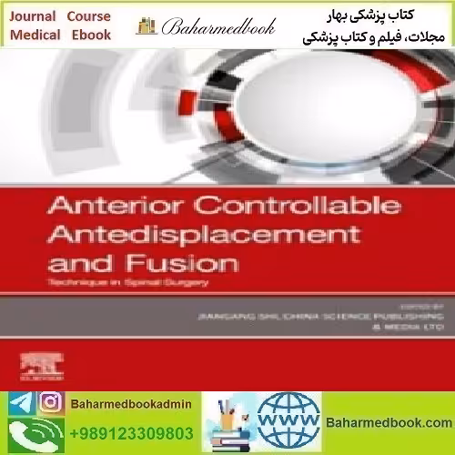 Anterior Controllable Antedisplacement and Fusion Technique in Sp