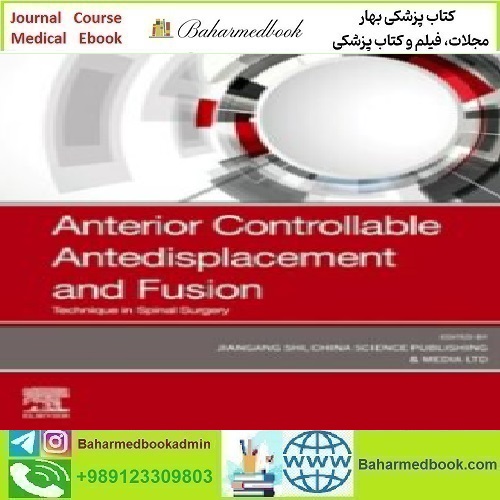 Anterior Controllable Antedisplacement and Fusion Technique in Sp