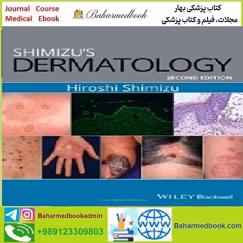 Shimizu's Dermatology TRUE PDF price 1€ - کتاب پزشکی بهار