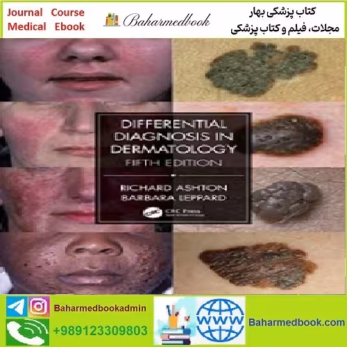 Differential Diagnosis in Dermatology TRUE PDF price 1€ - کتاب پزشکی بهار