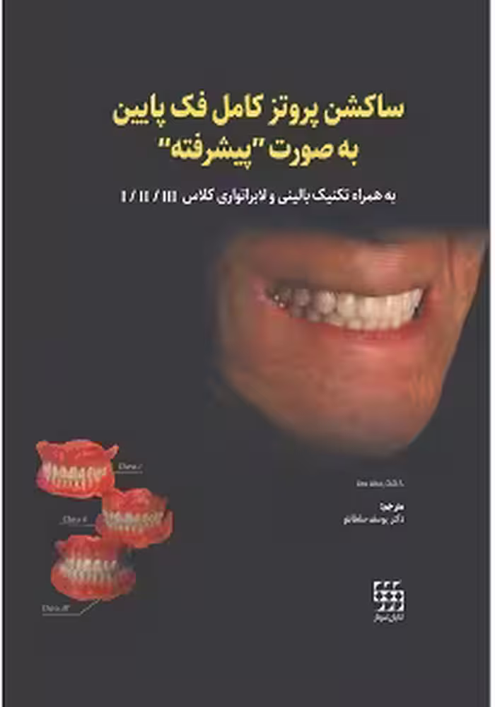 ساکشن پروتز کامل فک پایین به صورت پیشرفته