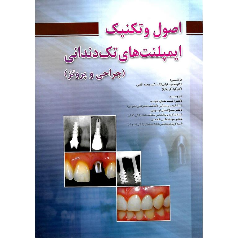 اصول و تکنیک ایمپلنت های تک دندانی