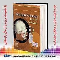 Functional Occlusion : From TMJ to Smile Design