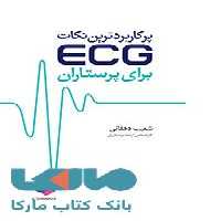 پرکاربردترین نکات ECG برای پرستاران جامعه نگر