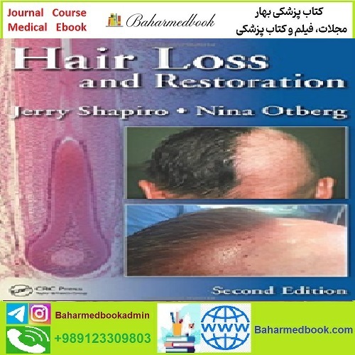 Hair Loss and Restoration TRUE PDF price 1€ - کتاب پزشکی بهار