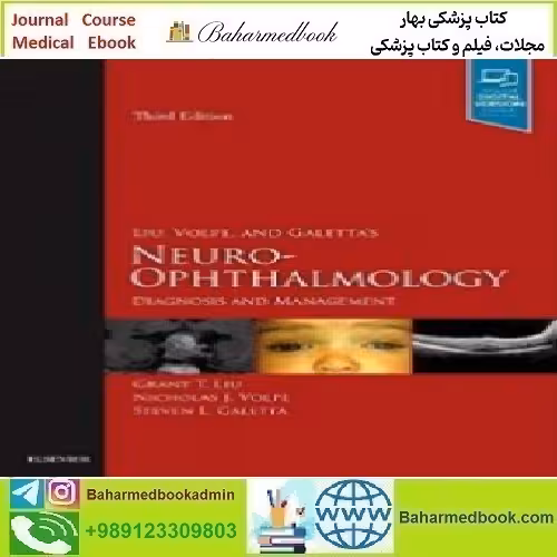 Liu Volpe and Galetta’s Neuro Ophthalmology Diagnosis and Ma