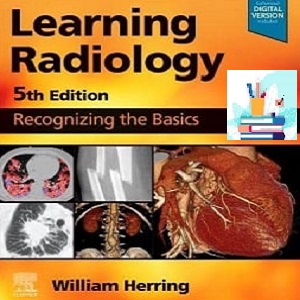 Learning Radiology Recognizing the Basics TRUE PDF VIDEOS price 3€ - کتاب پزشکی بهار