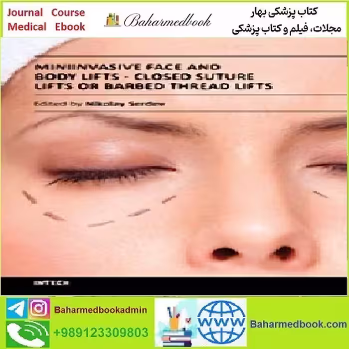 Closed Suture Lifts or Barbed Thread Lifts TRUE PDF price 1€ - کتاب پزشکی بهار