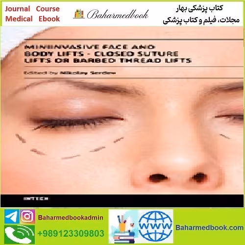 Closed Suture Lifts or Barbed Thread Lifts TRUE PDF price 1€ - کتاب پزشکی بهار