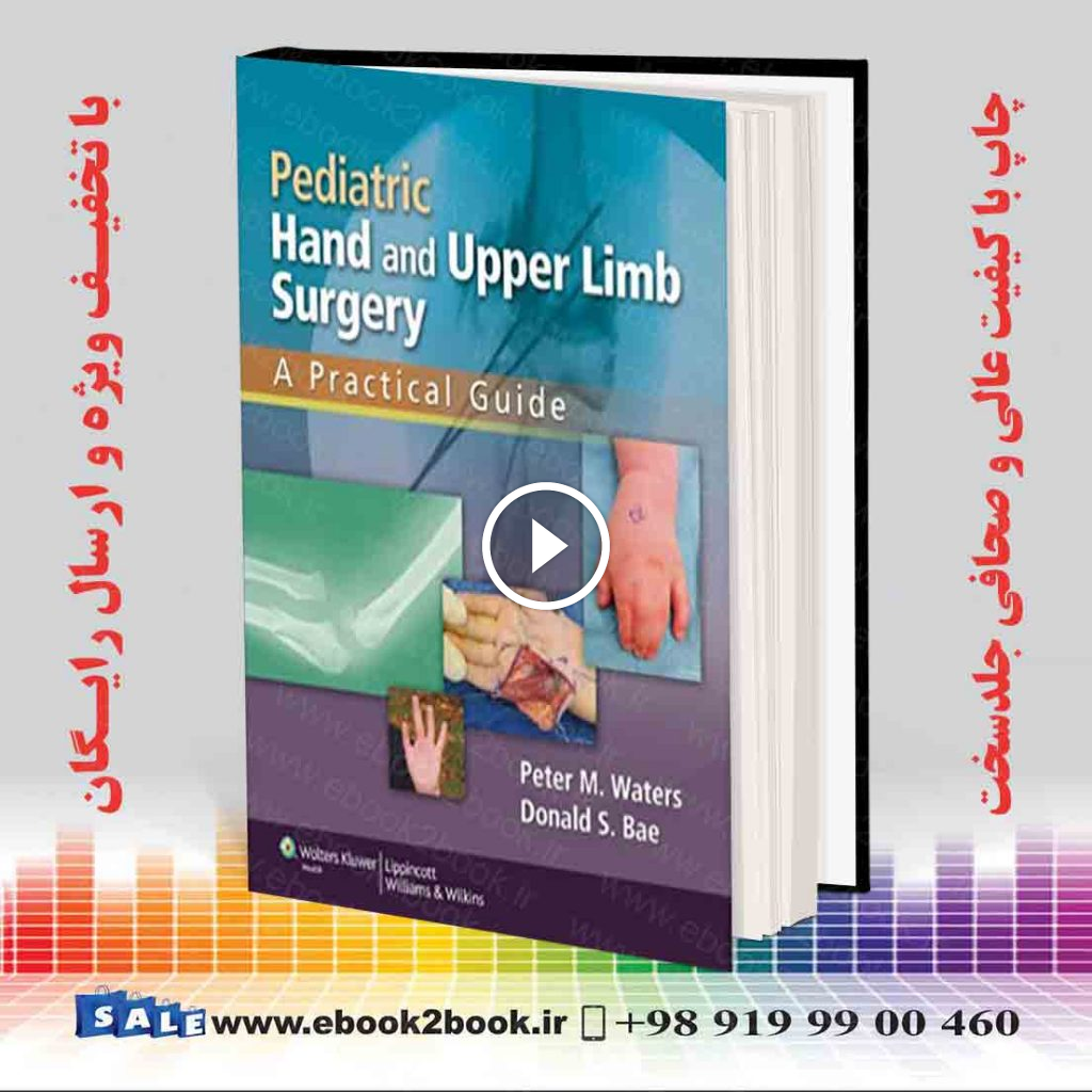 Pediatric Hand and Upper Limb Surgery
