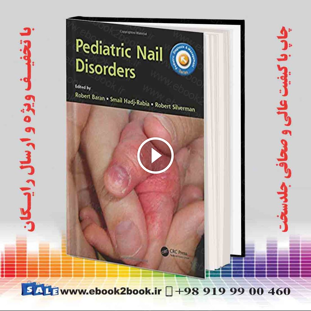 Pediatric Nail Disorders (Pediatric Diagnosis and Management)