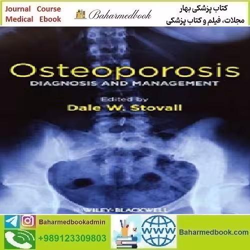 Osteoporosis Diagnosis and Management 2013 TR