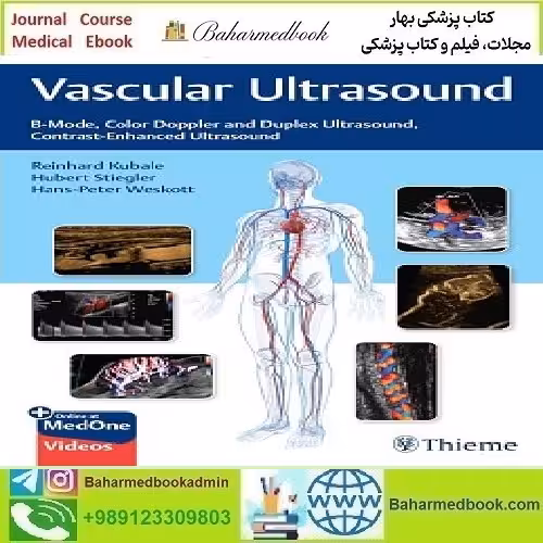Vascular Ultrasound B Mode Color