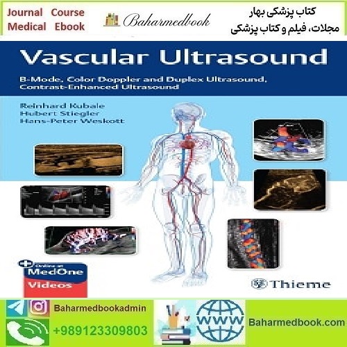 Vascular Ultrasound B Mode Color