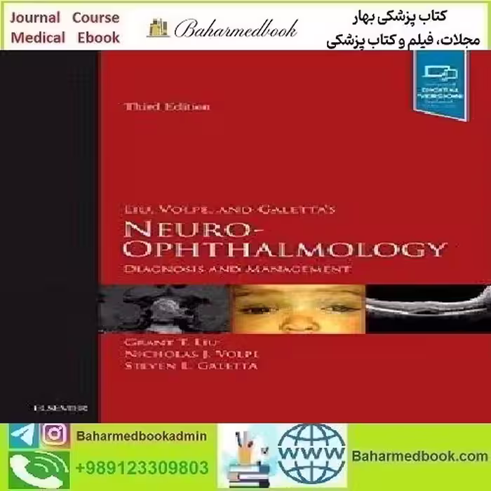 Liu Volpe and Galetta’s Neuro Ophthalmology Diagnosis and