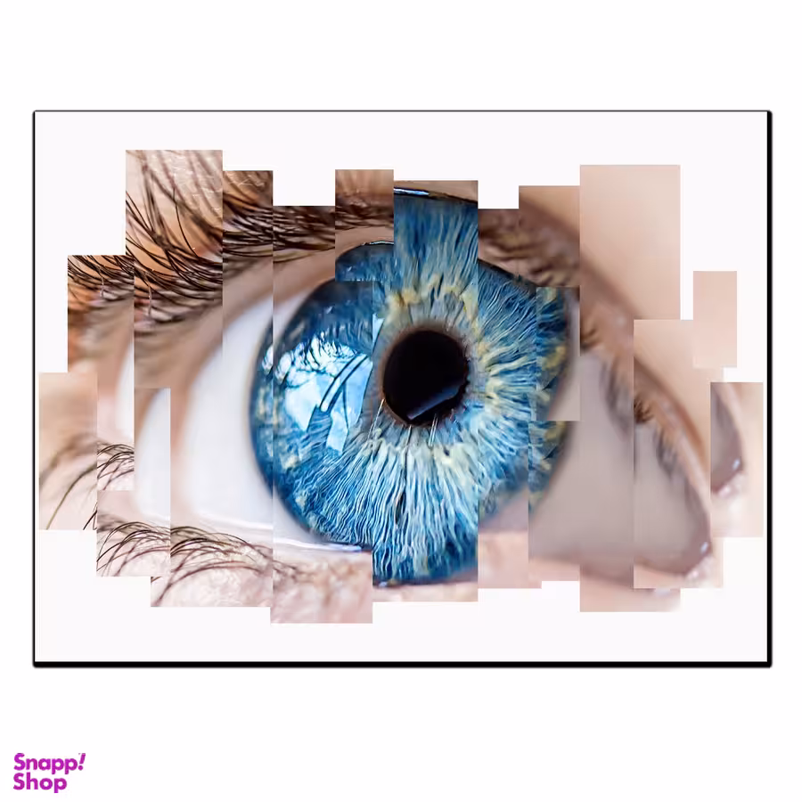 تابلو شاسی بکلیت طرح چشم پزشکی مدل SH-12533