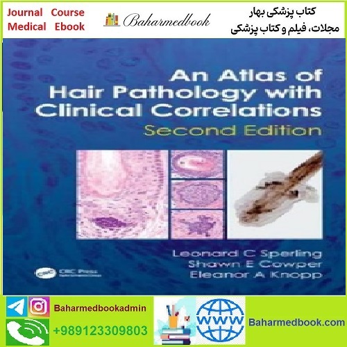An Atlas of Hair Pathology with Clinical Correlations TRUE PDF pr