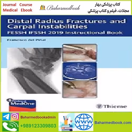 Distal Radius Fractures and Carpal Instabilities TRUE PDF price 1€