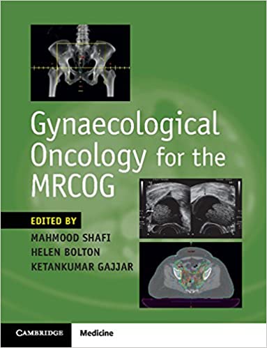 Gynaecological Oncology for the MRCOG, 1ed - کتاب پزشکی بهار