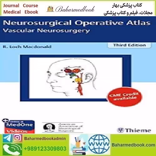 Neurosurgical Operative Atlas Vascular Neurosurgery 2019 TRUE