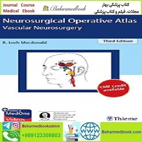 Neurosurgical Operative Atlas Vascular Neurosurgery 2019 TRUE